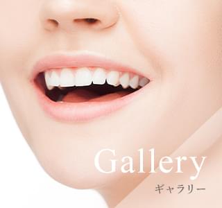 広島市西区・佐伯区・西広島エリアのセルフホワイトニング専門サロンCIELのギャラリー