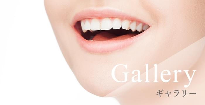 広島市西区・佐伯区・西広島エリアのセルフホワイトニング専門サロンCIELのギャラリー